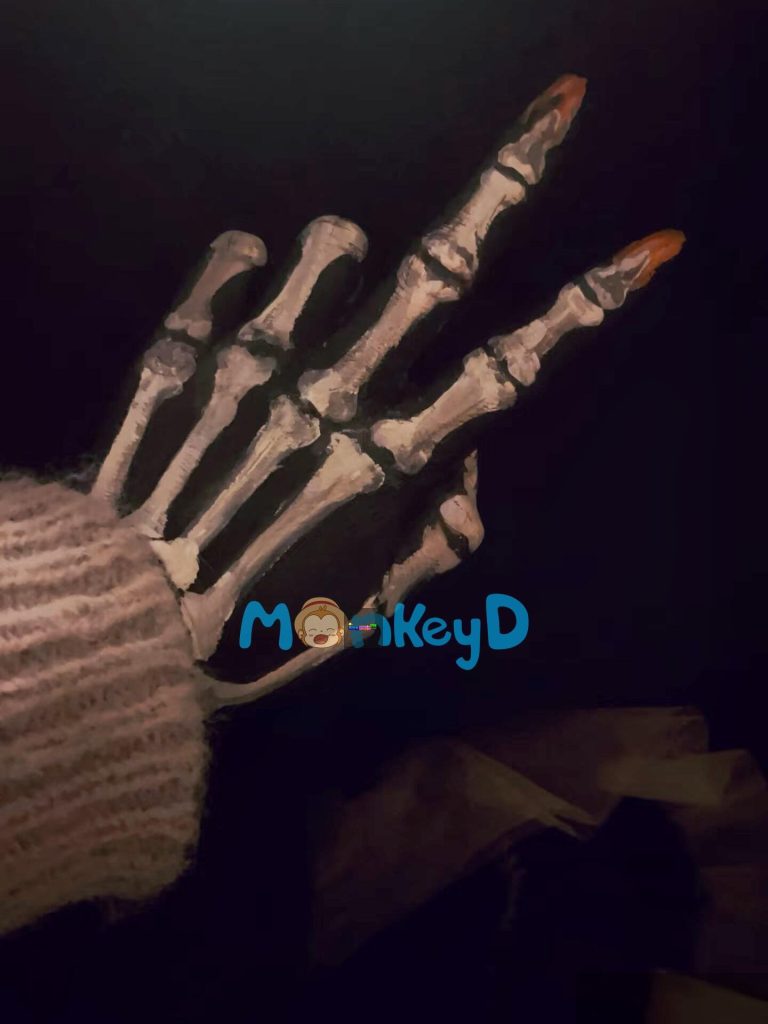 Ngón tay đứt trong chậu hoa